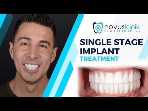 Logo of A Patient’s Transformation – 72-Hour Single Stage Dental Implants in Istanbul, Turkey