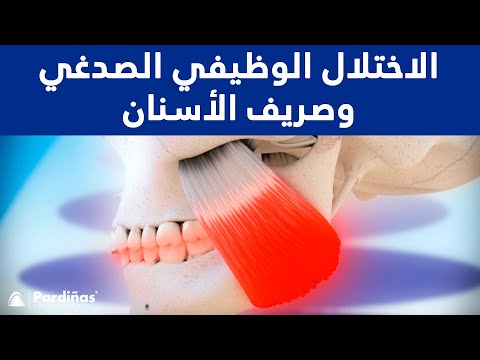 الاختلال الوظيفي الصدغي وصريف الأسنان ©