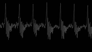 Download lagu Suara kentut mencret bikin ngakak mp3 Download lagu Suara kentut mencret bikin ngakak mp3