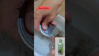 how to get rid of lice from hair permanently | lice removal comb | tits removal #antihairfall