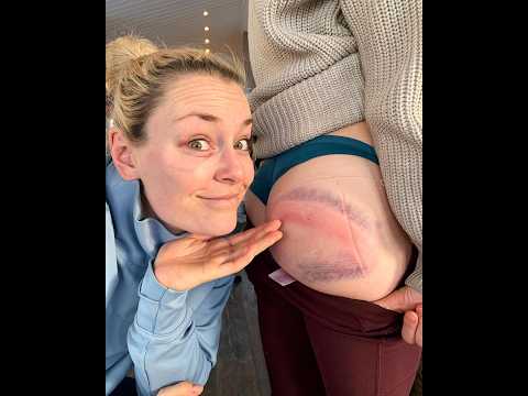 Karriere-Ende nach Horror-Sturz? Die ganze Wahrheit über Lindsey Vonns Verletzung!