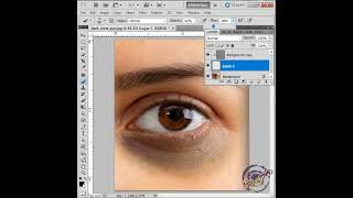 How to remove deep dark circles in photoshop