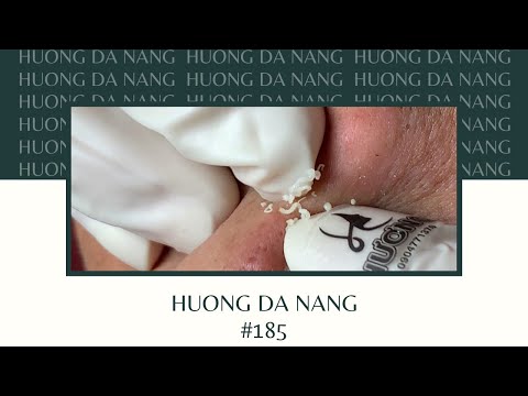 #185 | Huong Da Nang