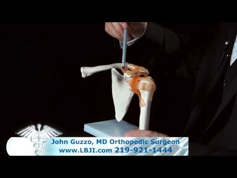 Dr. John Guzzo Explains AC Joint Injuries