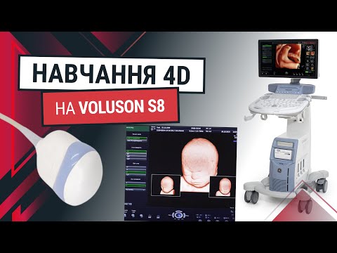 3D/4D конвесний датчик до GE Voluson S8 – навчання - Статті RH