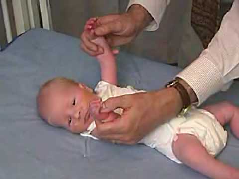 neurology exam: newborn-abnormal: Tone - Hand Position