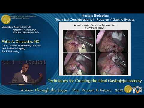 Les techniques de la création de la gastrojéjunostomie parfaite