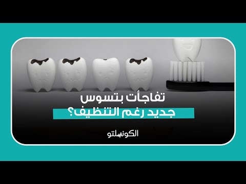 تسوس الأسنان.. لماذا يحدث رغم التنظيف الدائم؟ 