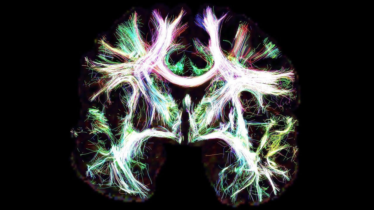 Fibernavigator streamline visualization