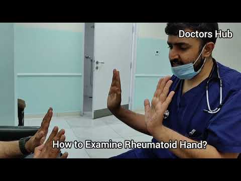 Rheumatoid Arthritis Hand Exam: A Step-by-Step Guide || Dr. Qasim Ishtiaq