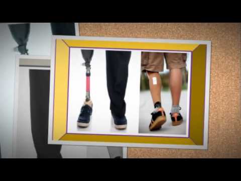 Chemical laminated foot chopart symes prosthesis (ankle disa...