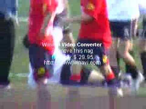 Me reventaron , tibia y perone y los ligamentos K.O.