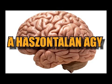 mit kell tenni, ha erekciója gyenge