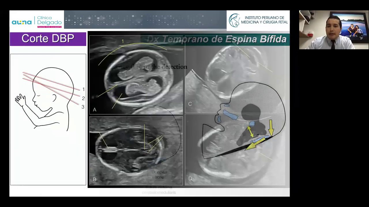 Importancia de la Ecografía del Primer Trimestre | GE Healthcare