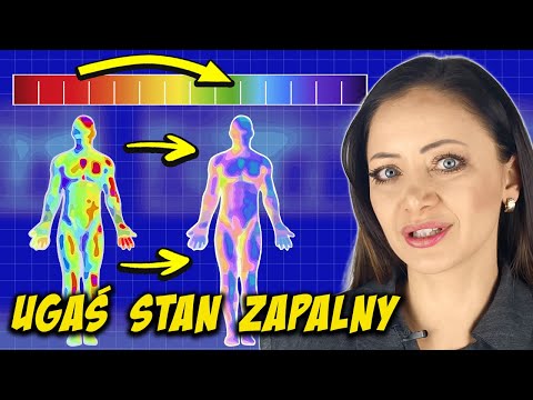 Te produkty gaszą stan zapalny (cichy zabójca zdrowia)