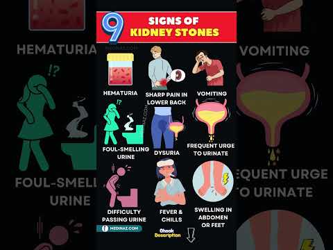 9 Signs of Kidney Stones You Shouldn’t Ignore | How to Know If You Have Kidney Stones
