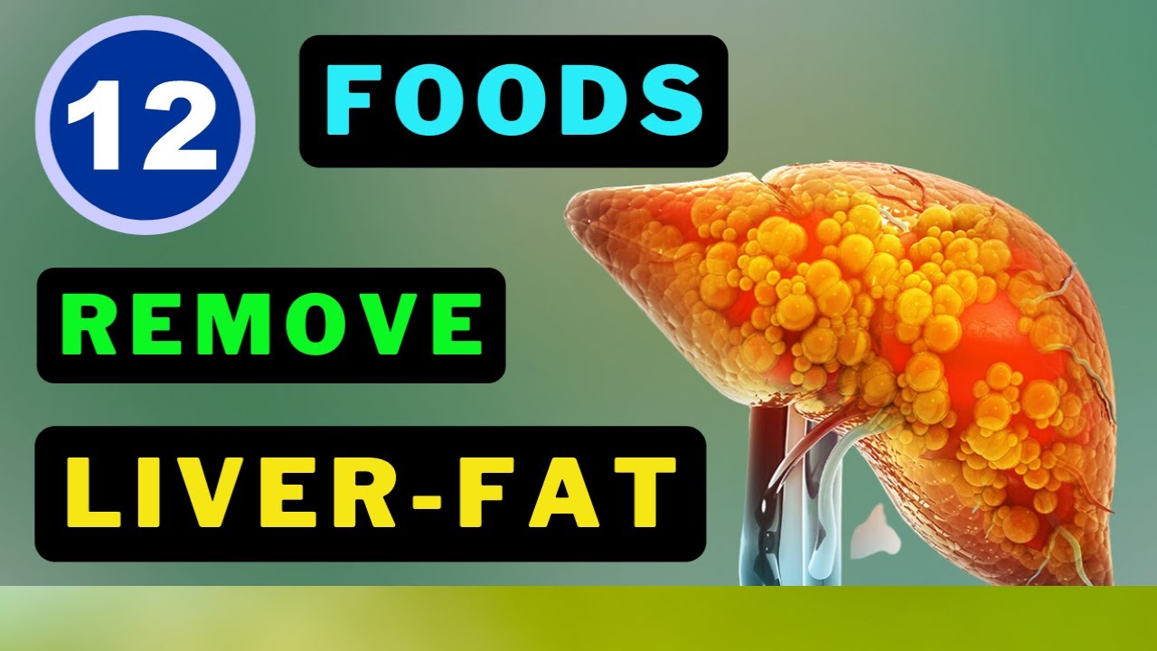 Eat These 12 Foods NOW to Detox and De-Fat Your Liver!