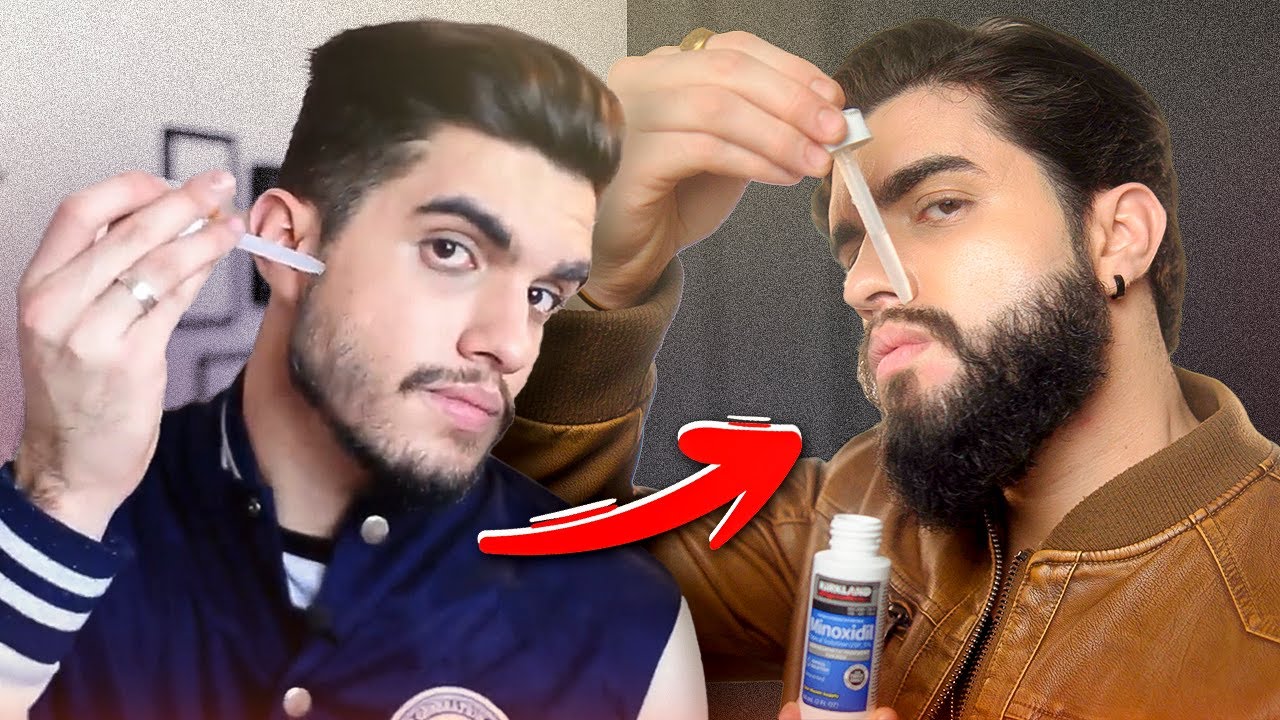 Como usar MINOXIDIL para crescer BARBA 🧔🏻‍♂️