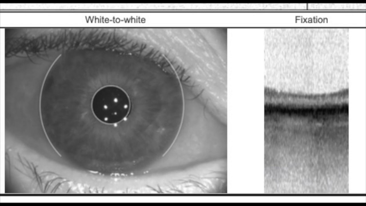 Biometry basics with the IOL master 700