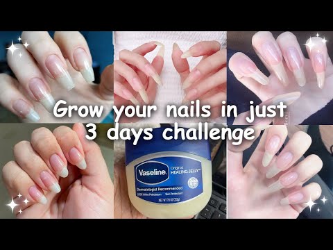 How to grow your nails in just 3 days (naturally)|100% working