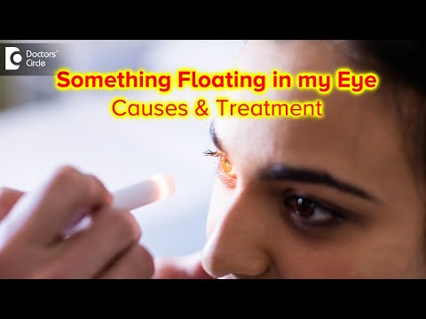 When should i worry about Eye Floaters? Cause, Symptoms & Treatment- Dr. Sunita Rana Agarwal