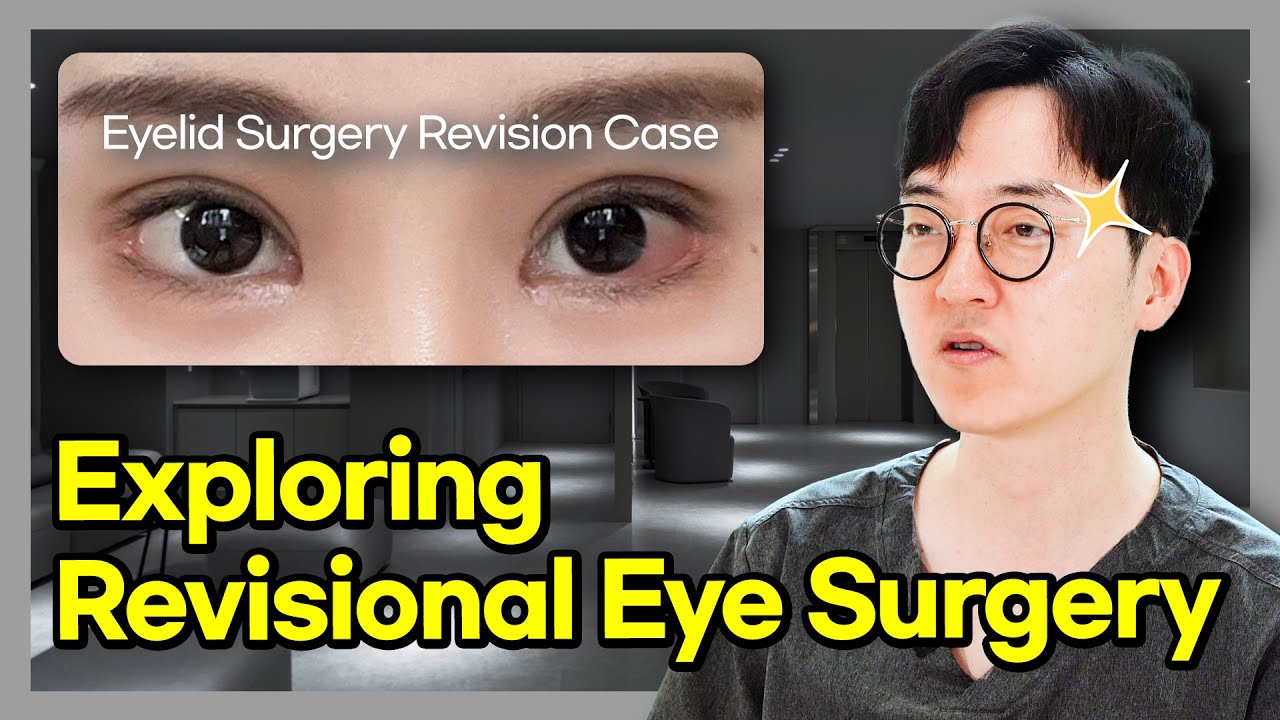 Revisional 目の整形