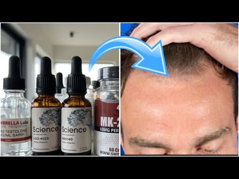 Do Sarms Cause Hair Loss!? (Ft. Dodge Feeler)
