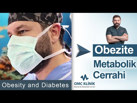 Obezite ve Metabolik Cerrahi Istanbul 2021-Op. Dr. Necat Kan| Obezite İstanbul - Diyabet İstanbul