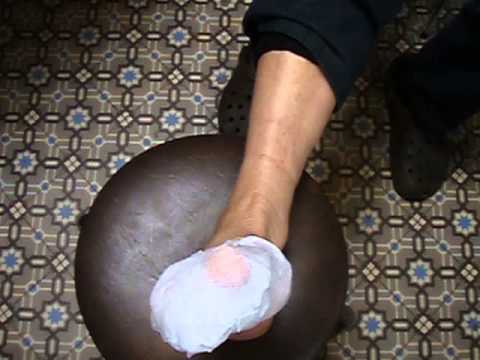 comment soigner oignon petit orteil