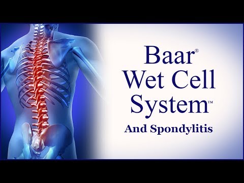 Baar Wet Cell™ System and Spondylitis