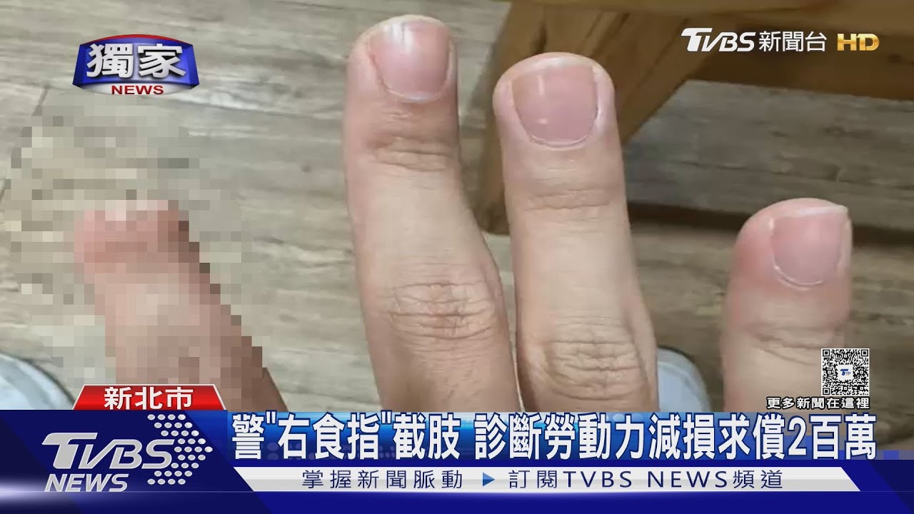 警「右食指」截肢診斷勞動力減損 求償2百萬