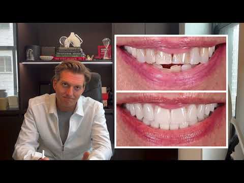 Fixed her BITE and brought DECADES back... CASE REVIEW