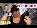 Strapless Adhesive Bra Tested By Plus Size After Breast Reduction