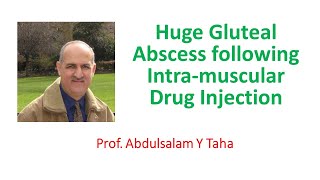Huge Gluteal Abscess following Intra muscular Drug Injection