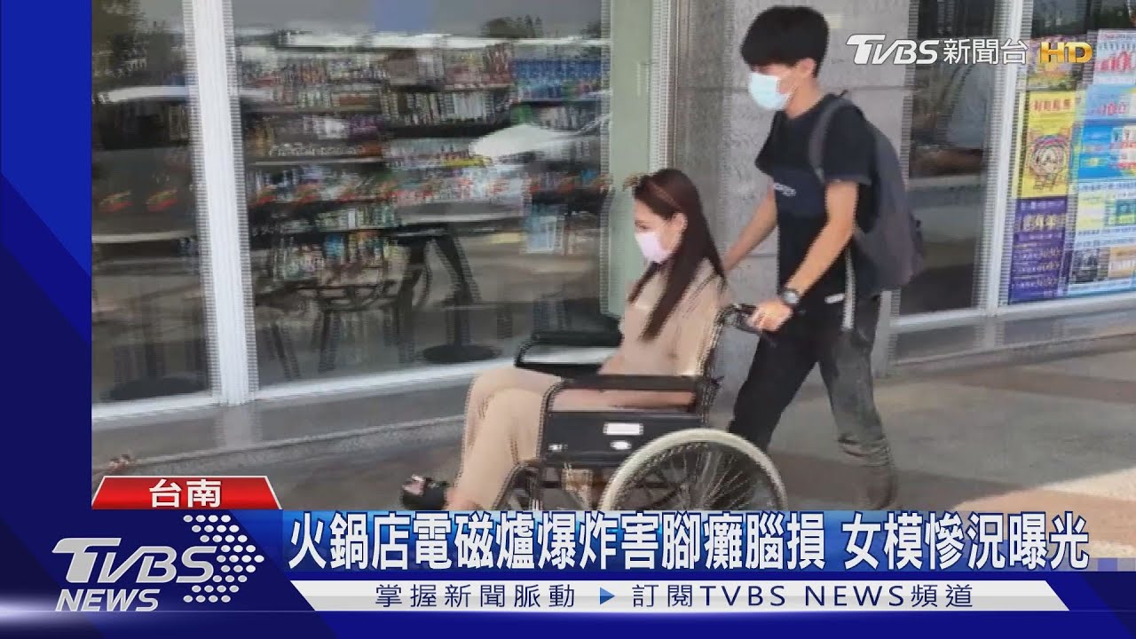 火鍋店電磁爐爆炸害腳癱腦損　女模慘況曝光
