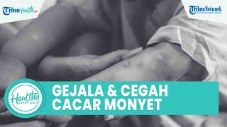 Waspadai Anak Rentan Terkena Cacar Monyet, Kenali Gejala & Cara Cegah agar Tak Mudah Tertular