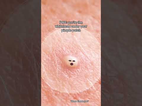 POV: You’re the whitehead under your pimple patch 👀