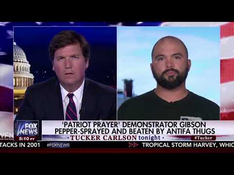 Berkeley Antifa Brutally attacks me (CONCUSSION), Tiny and Joey Gibson! Tucker is real news!!