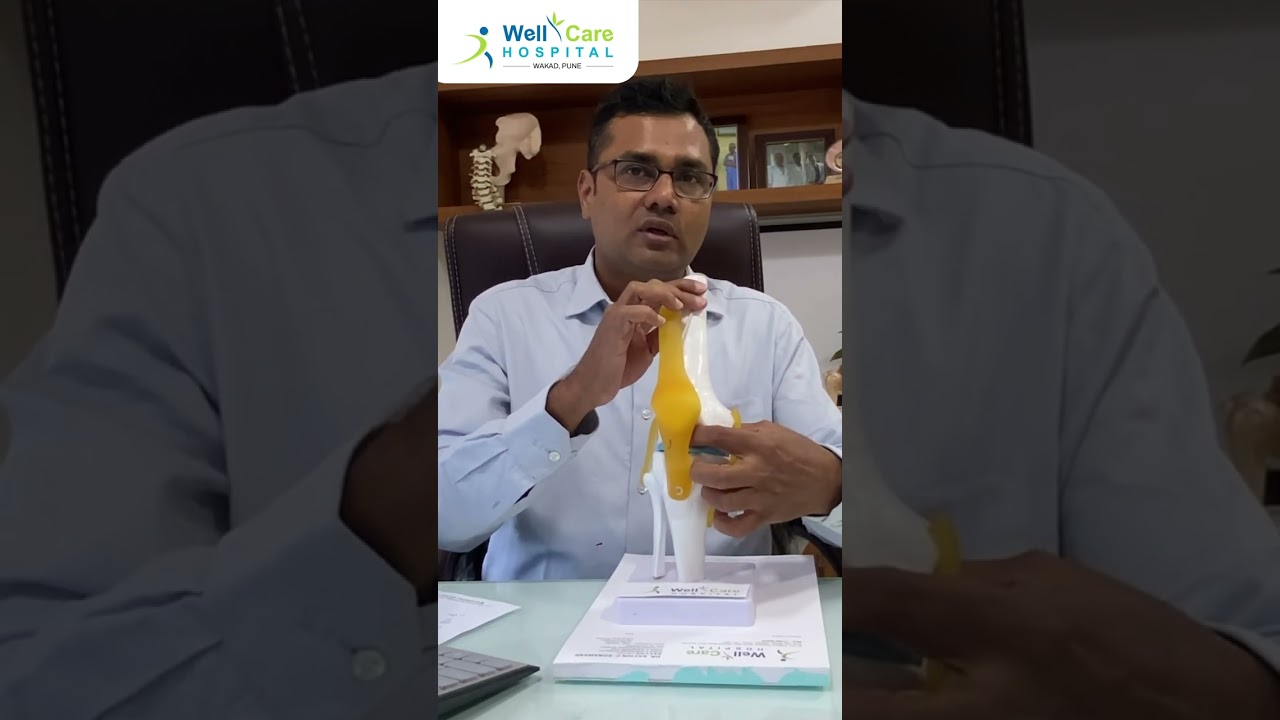 Meniscus tear information in Marathi मेनिस्कस टियर माहिती मराठीत