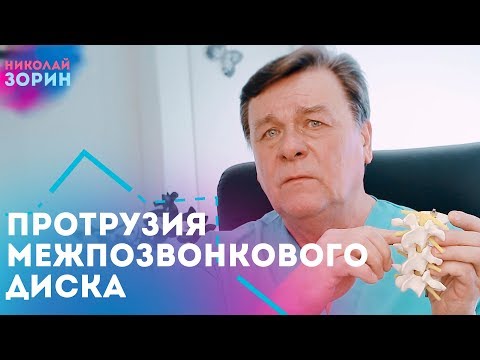 Бурсит плечевого сустав Как исправить деформацию коленного сустава