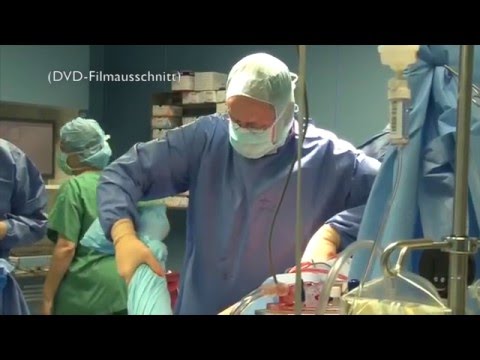Wie Gelatine von Verbindungen verwenden Präventive Übungen auf die Kniegelenke