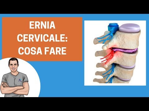 Grassella foto Ginocchio farmaci trattamento congiunto gonartrosi