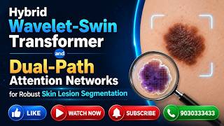 Download lagu Hybrid Wavelet-Swin Transformer Skin Lesion Segmentation | Final Year CSE Major Project 2026 🚀 mp3 Download lagu Hybrid Wavelet-Swin Transformer Skin Lesion Segmentation | Final Year CSE Major Project 2026 🚀 mp3
