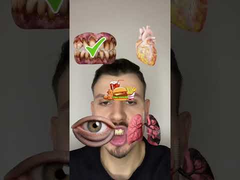 Fix Organs Problems IQ 😅 #keşfet #fyp #funny #follow #foryou #comedy #youtubeshorts #shorts