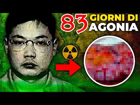 Living in a DECEASED Body for 83 Days (WORST DEATH EVER)