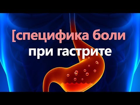Замена коленного сустава черновцы цена Правильная ходьба при остеохондрозе