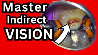 Master Indirect Vision - One of the Hardest Beginner Dental Skills