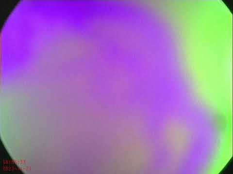 TME Dr. Edison Pérez O.M.C