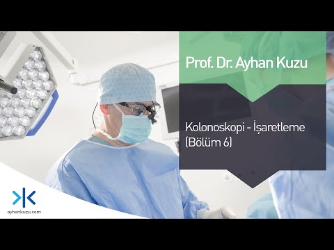 Kolonoskopi - İşaretleme (Bölüm 6)