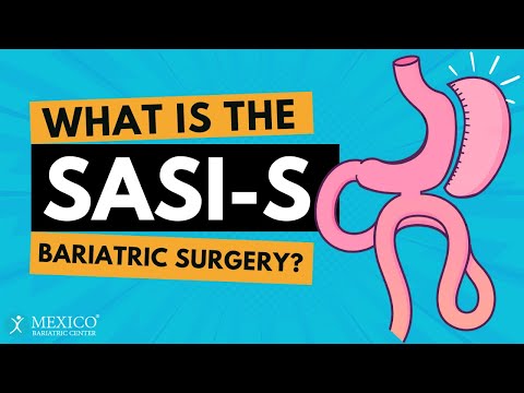 What is SASi-S Bariatric Surgery?